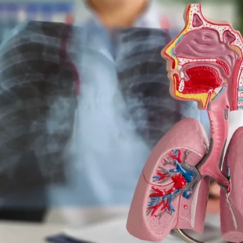Parazitoze ale aparatului respirator Parazitoze ale aparatului respirator
