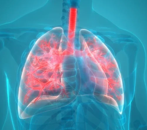 spital-bisericani-pneumonii PNEUMONII
